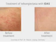 Thumbnail for domenoto