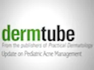 Thumbnail for fosulepa