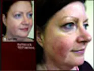 Thumbnail for galasigi