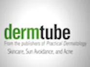 Thumbnail for hozoteet