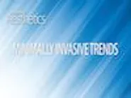 Thumbnail for inopegow