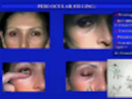 Thumbnail for jikogeti