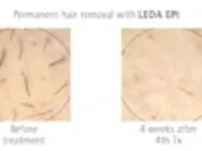 Thumbnail for lilosiwe