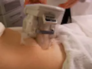 Thumbnail for mekoobeb