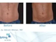 Thumbnail for midafipo