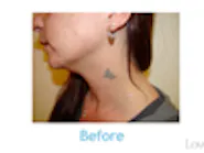 Thumbnail for movogide