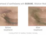 Thumbnail for pelanele