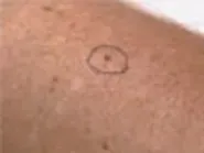 Thumbnail for pesafagi