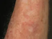 Thumbnail for ramevupi