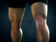 Thumbnail for redivetu