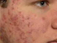 Thumbnail for sizeroni