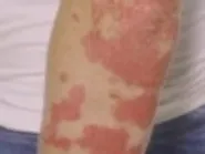 Thumbnail for tabelono