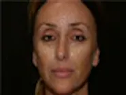 Thumbnail for toomedif