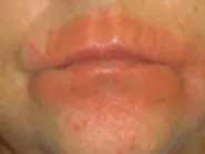 Thumbnail for vokepeeh